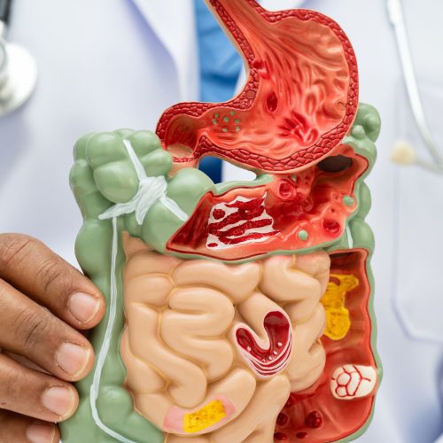 gstroenterology